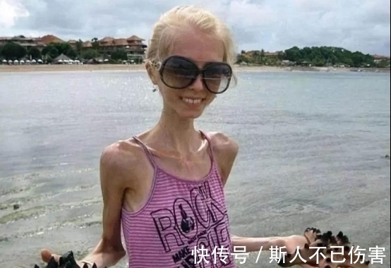 高血脂|42岁女子心悸1年暴瘦35斤，医生：4种食物是“刷脂王”，可多吃