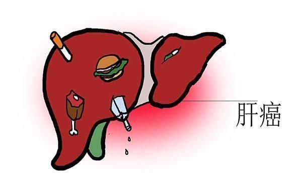 祸根|家里哪些东西,是肝癌的“祸根”早点扔了,别舍不得