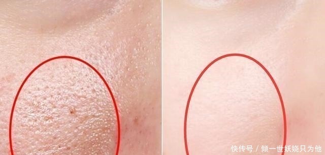 被国人逼上绝路！屈臣氏38元“贱卖”兰蔻粉水，这下雅诗兰黛慌了！