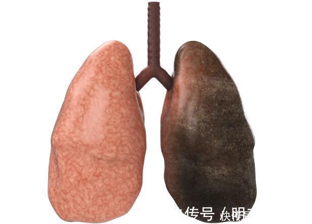 心脏类|经常胸闷胸痛，不仅是心脏问题！也可能是这几种疾病在“作乱”！