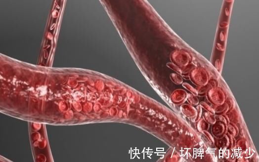 食物|日本平均寿命高于我国，只因2种食物，而2种食物却产于我国！