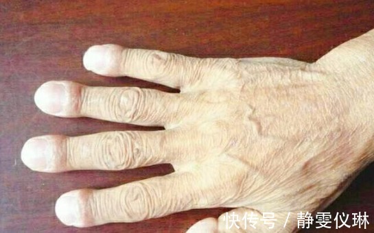 腹式呼吸|养肺防癌，牢记“二白二水”，润肺排毒，消除炎症