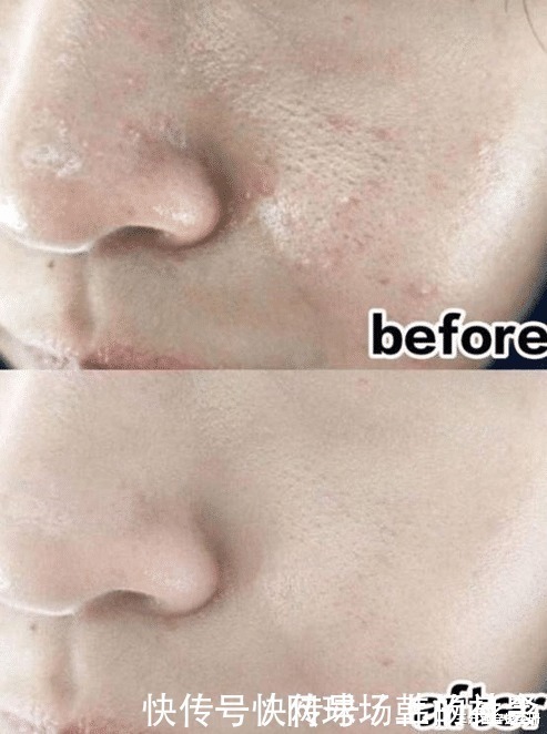 口红|买家秀与卖家秀“区别太大”,不是因为你没模特的五官,而是皮肤