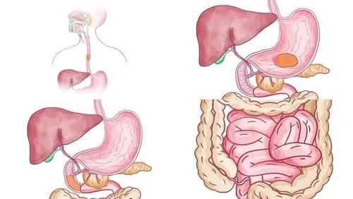 健康|健康源于肠道，你的肠道还好吗？