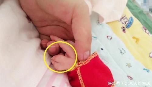 孕检|孕检结果正常,却生出畸形宝宝,怀孕多少周做排畸检查准确率最高