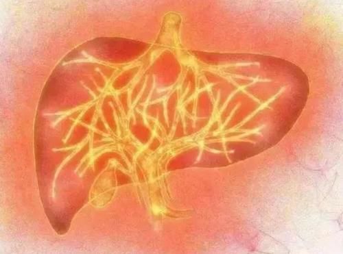 肝火过旺|经常失眠是肝火过旺所致?建议:牢记“3不2要”,或降肝火调睡眠