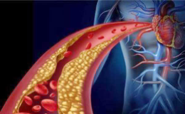 鸡蛋|高血脂,是一天吃一个鸡蛋好还是隔几天吃一个好?文中帮你分析
