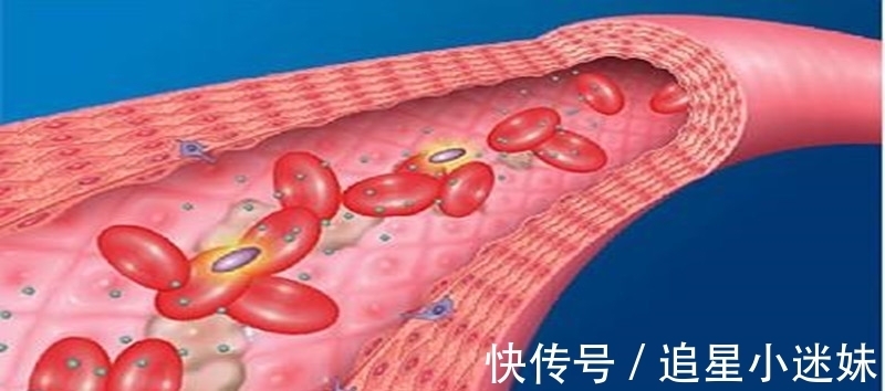 高血糖|糖尿病人空腹血糖总在6.5左右,降不到6.1以下,有啥办法?