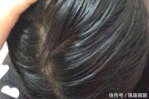 梳子|头发洗完隔天油?内行人:洗头时不仔细这4点,干性发质也易油!