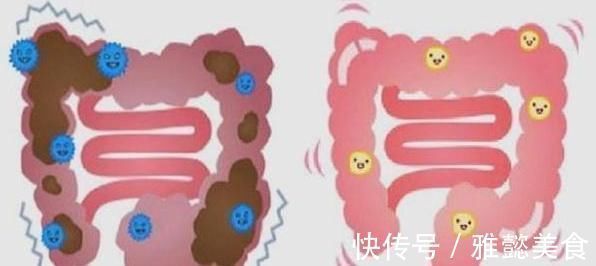 饮食习惯|胃不好的人,常吃幽门杆菌的3种“天敌”,胃炎就会慢慢好转!