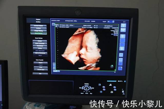 b超|怀孕40周B超检查全攻略，B超产检目的和注意事项，孕妈要知道