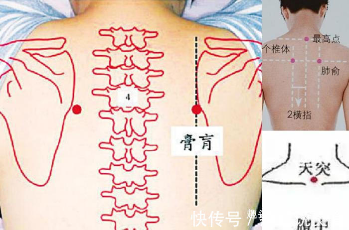 三伏贴|冬病夏治抓住一年中养阳的40天，阳虚的人记得提前安排好3件事