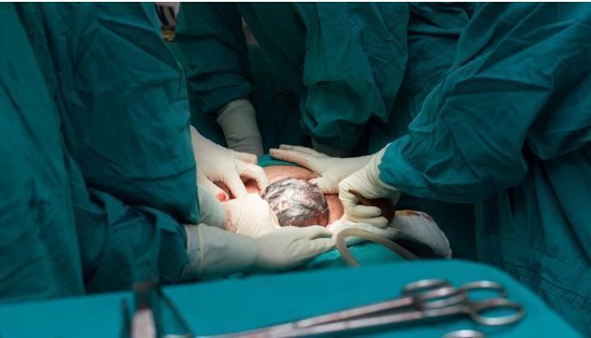 婴儿|产妇顺产好,还是剖腹产好?两者谁最伤害婴儿呢?让医生来告诉你