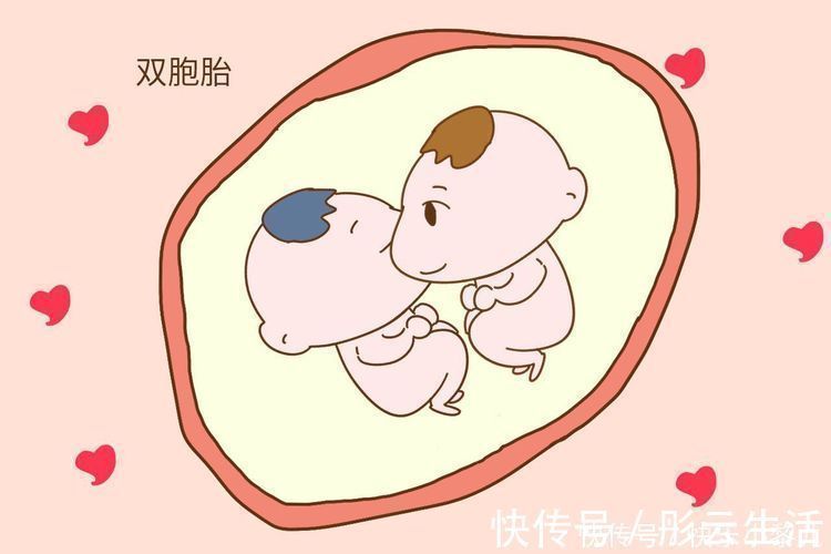 多胎|为什么生双胞胎的人越来越多,不是基因问题,关键在这里