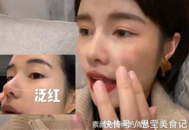 张轻轻|美女模特警告世人谨慎整容,自曝隆鼻后遗症:鼻孔流脓奇臭无比