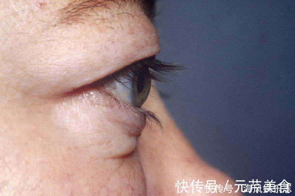 脸上有张“疾病地图”,哪里生病了,它会“告诉你”,快对照自检