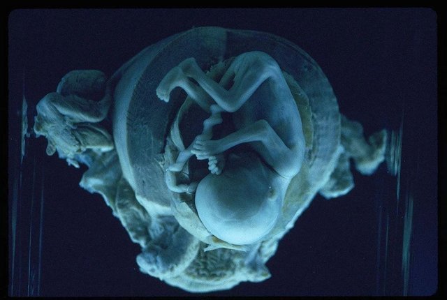 判断|胎盘是否老化怎么判断?关系胎儿发育的关键,孕妈不可大意