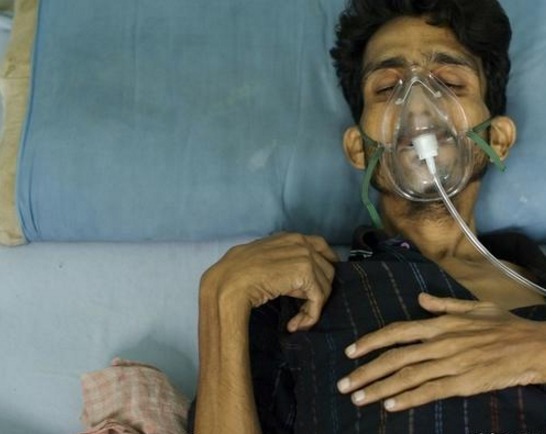 肺部|肺不好的人,头部若有3个表现,可能肺癌要来,最好去检查一下