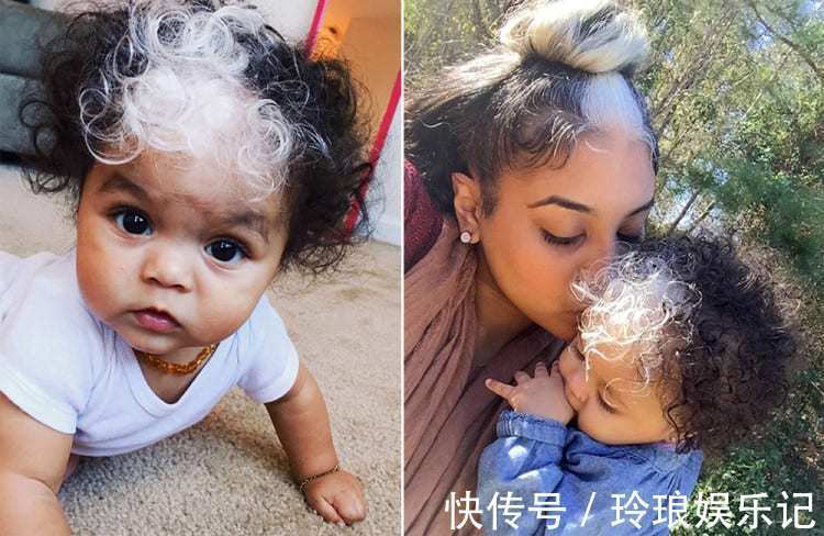 脚趾|19个“被上帝挑选过”的特殊基因人类,怎么梳都不整齐的头发