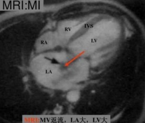 心肌$达芬奇曾画出心脏细微结构图,如今专家分析25万张图像才找到