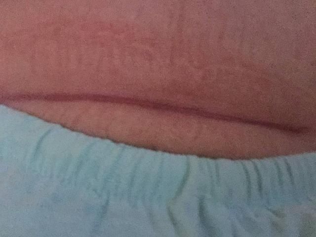 剖腹产|第一次剖腹和第二次有什么不同医生说出实话,孕妈要心里有数