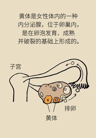 诱因|这种腹痛常被误任宫外孕，背后诱因要牢记