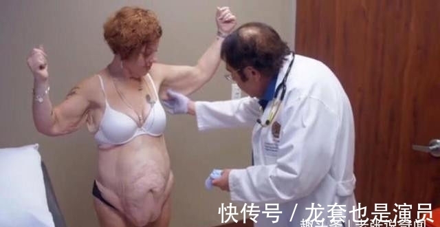 减肥成功|女子减肥成功,一年减200多斤,结果看到自己的皮肤,不淡定了