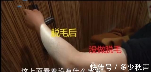 院方 女子花6800做16次脱毛手术,术后毛发开始疯长,医院:个人问题!