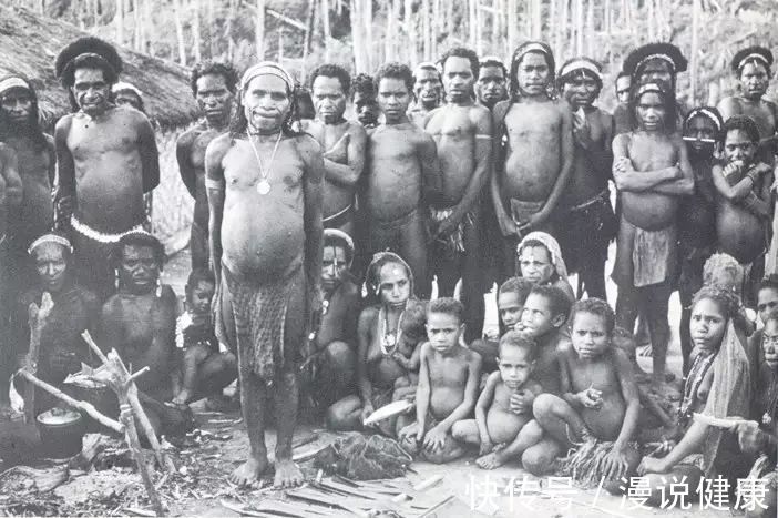 抛开伦理和道德,人肉到底能吃吗?这群食人族,却因遭受“诅咒”