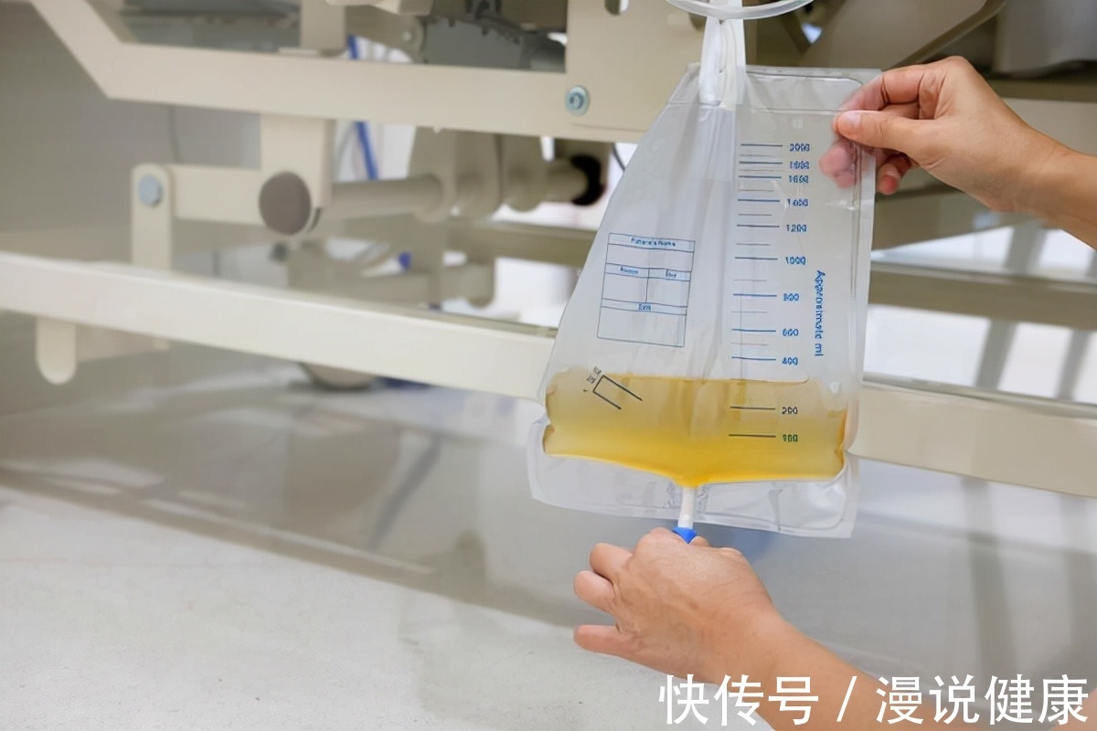 泡沫|疾病前来,排尿告知?排尿时出现这3个表现,还真不是什么好事