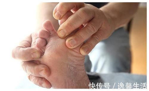 减肥|花椒加一物,被称为“头号泻药”,坚持吃一周,把便秘口臭都逼走