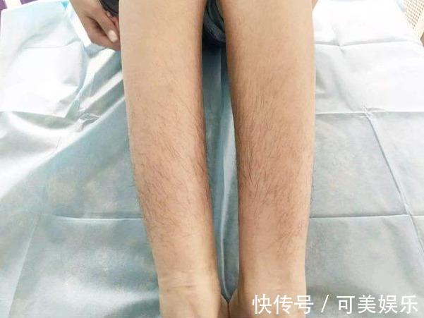 特征|男性身体出现5个特征,暗示更年期已到!尤其45岁后,更要注意