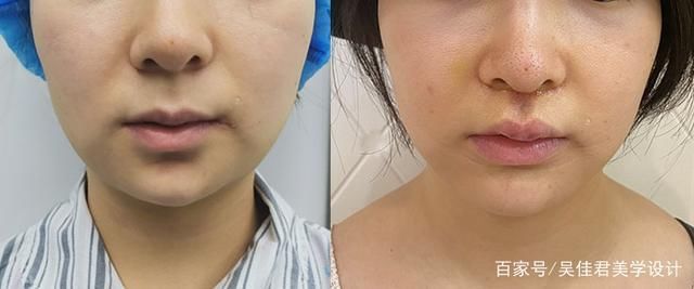 从老阿姨到小姐姐，降低年龄感她选择这样做！