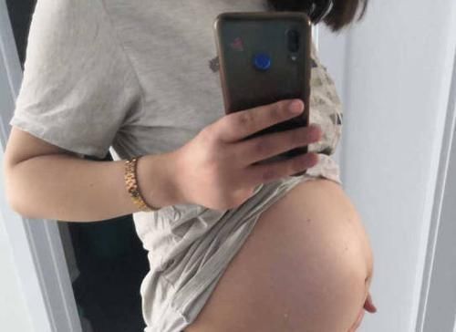 孕妇|孕妇nt查出畸形,准妈妈第一次听说,奇了个怪