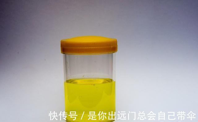 尿液|男性晨起“第一泡尿”，若有这三个特征，那就恭喜你，肾脏还不错