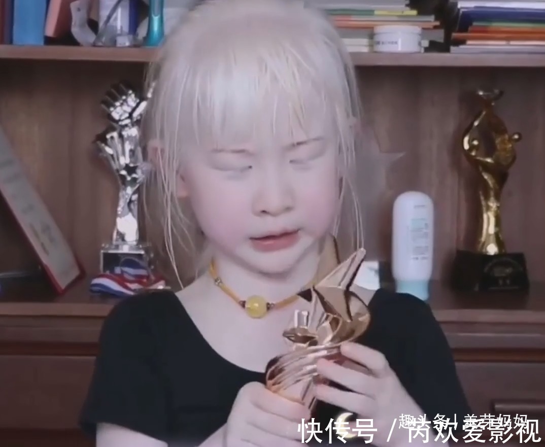 小女孩|女孩患白化病全身皮肤雪白,出门吓哭小朋友,女孩的表情让人心碎