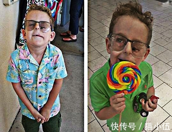 眼睛|小男孩出生时父母吓一跳,眼睛竟然长在脸上,长大后了不起!