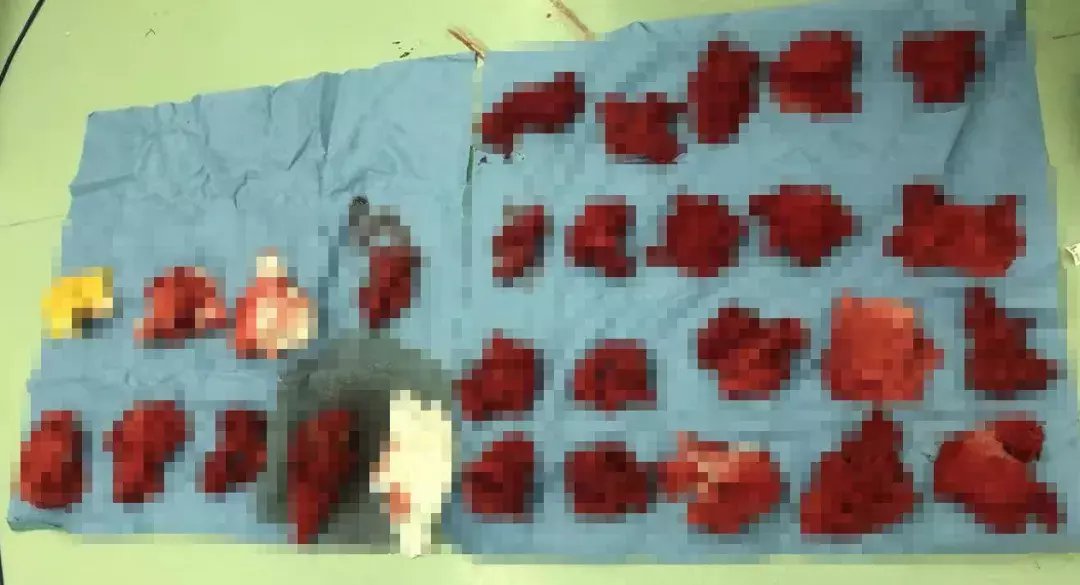 马善朵|长这么大，没跑过这么快……