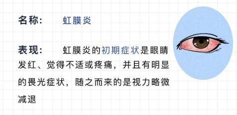 红血丝|不停打嗝、眼睛出现红血丝......这些小毛病其实非常危险