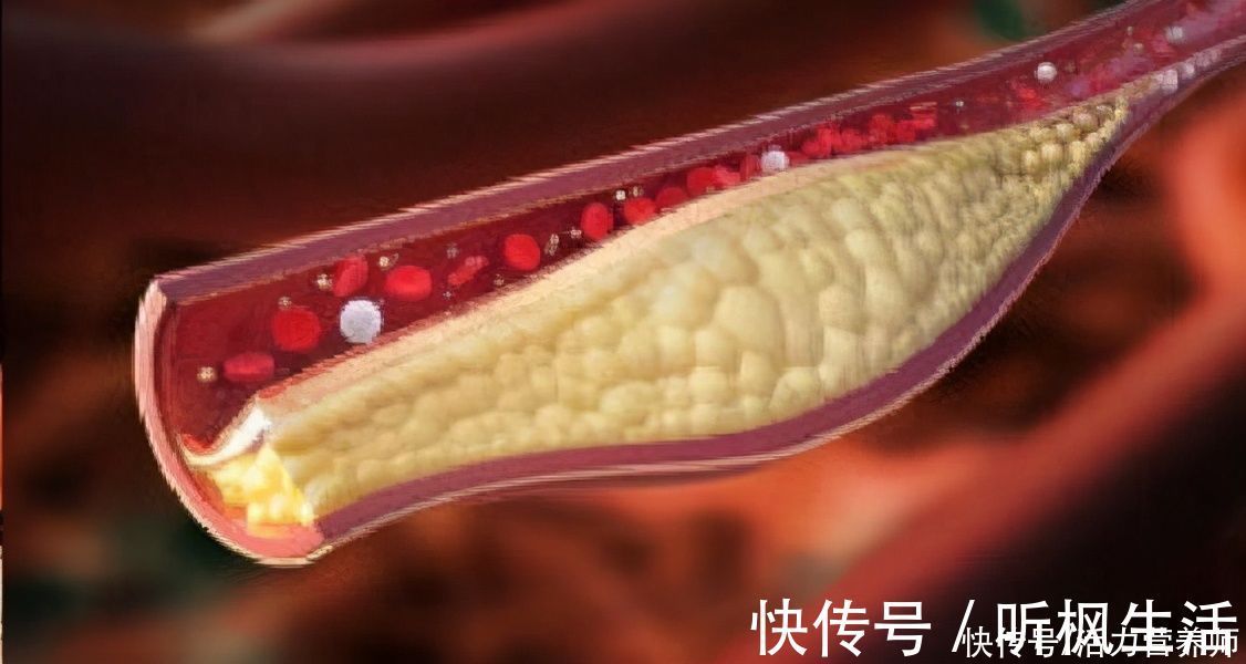 中老年人|“低压高”与“高压高”哪种更危险?应该如何判断?别看错了