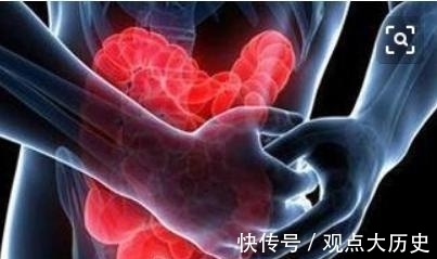肺部|肿瘤科医生:体检时多做“这一项”检查,多数癌症能早期发现
