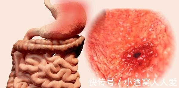 长寿体质|人到55岁之后,若能躲过4种“大病”,恭喜你,或拥有长寿体质