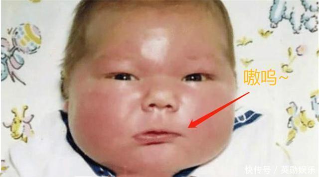 肥胖|当年一出生就轰动美国的“巨婴”,体重高达14.5斤,现状如何