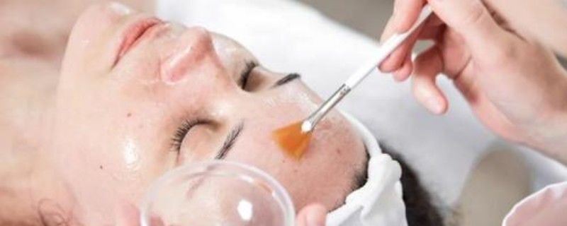 刷酸能淡化痘印吗