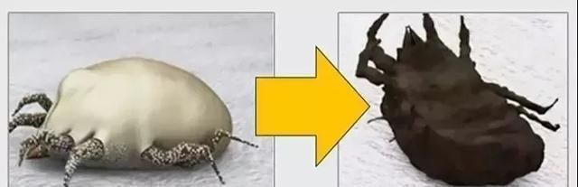 床上螨虫成窝,家里老人小孩老过敏,教你1个土法子,让螨虫消失