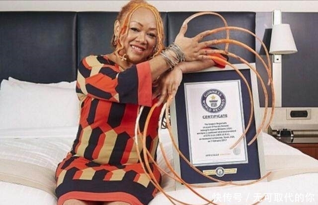 女孩23年来竟没剪过手指甲,都感叹女孩平时怎么上厕所的!