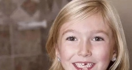 牙齿|如果用牙齿来判断颜值的话,大家觉得问题容易出现在哪里呢?