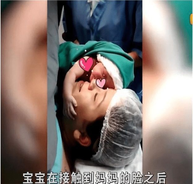 剖腹产|宝宝才刚刚出生,就抱着妈妈不放手,画面真的是好感人