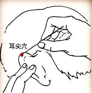 治疗|神奇的中医外治法!面背部痤疮服汤药5年无效,穴位疗法一次即愈