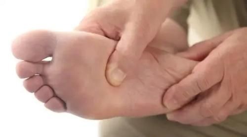 血脂升高|血脂高不高,看脚就知道,若没有这4种症状,恭喜,血管还算通畅